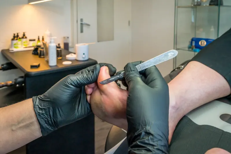 Eelt verwijderen met een mesje, met handschoenen